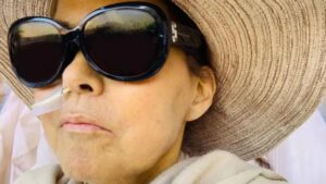 Mujer perdió casi 30 centímetros de estatura por esta extraña enfermedad